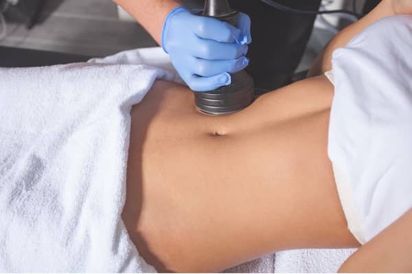 What is CoolSculpting